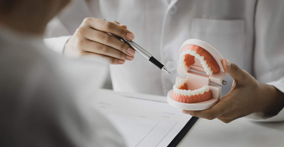 Dentist holding fake teeth showing a cavity 